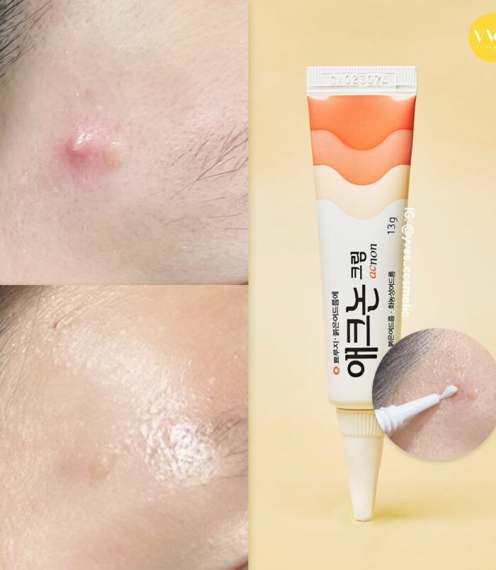 img_1311-2 img_1311-2